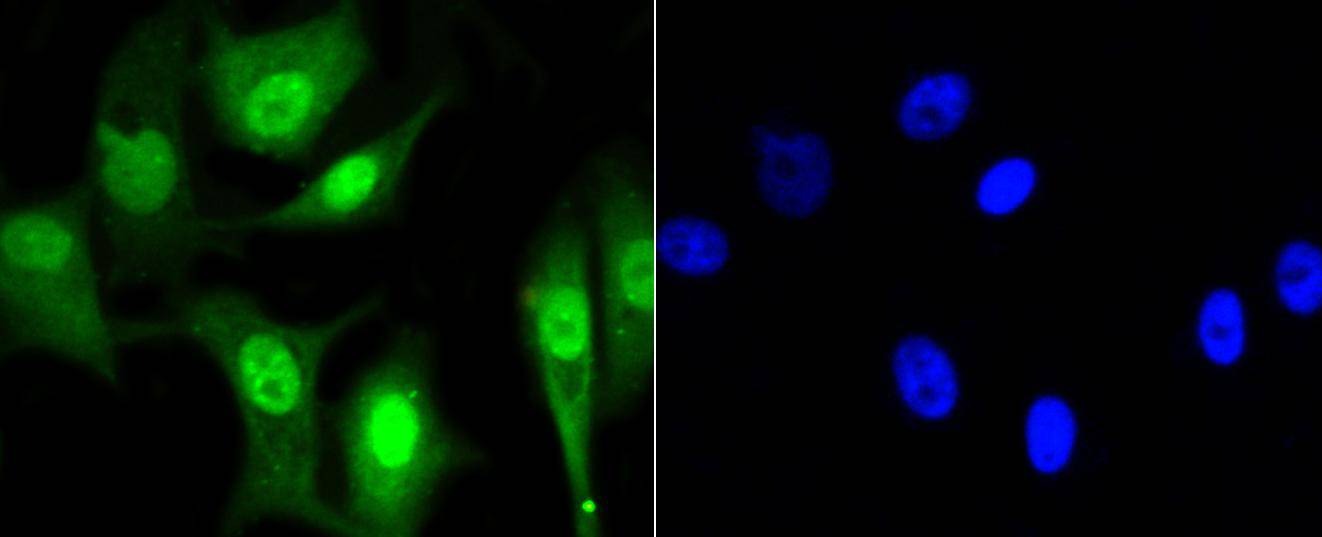 Anti-CBX5 Antibody (5G758)