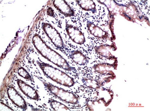 Anti-CBX3 Antibody (1K457)