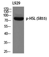 Anti-Phospho-HSL (Ser855) Polyclonal Antibody