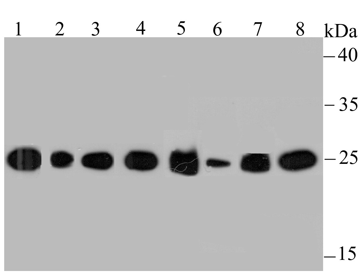 Anti-HGPRT Antibody (2V553)