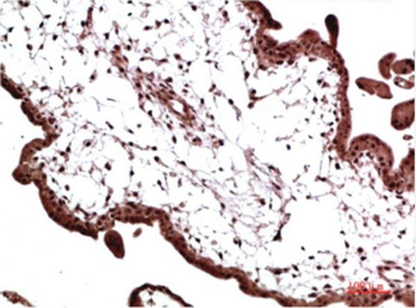 Anti-CBX3 Antibody (1K457)