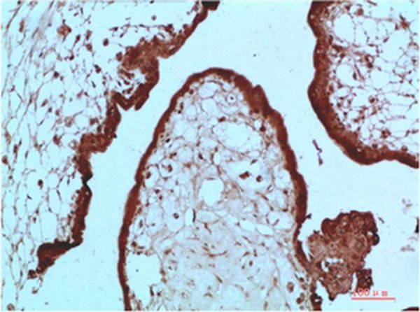 Anti-CBX5 Antibody (6Z70)