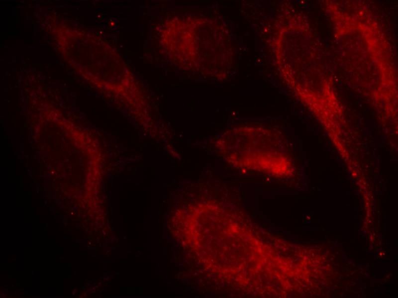 Anti-Phospho-HSF1 (Ser307) Polyclonal Antibody
