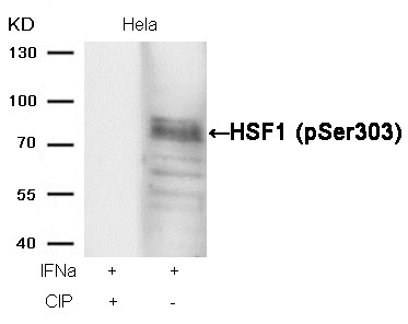 Anti-Phospho-HSF1 (Ser303) Polyclonal Antibody