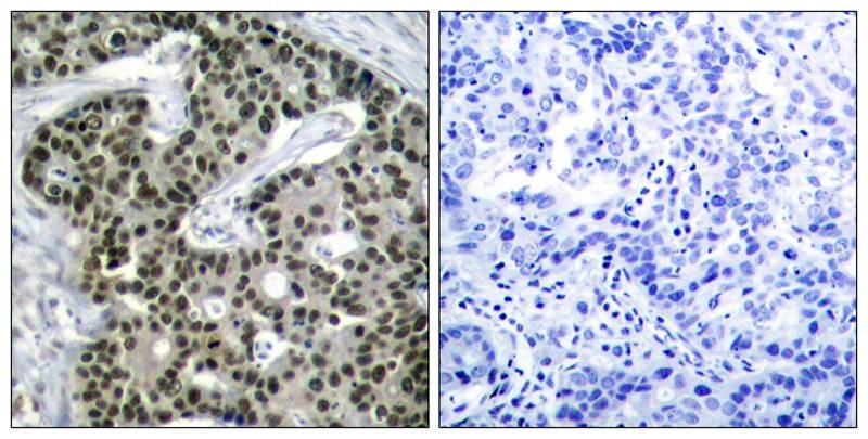 Anti-Phospho-HSF1 (Ser303) Polyclonal Antibody