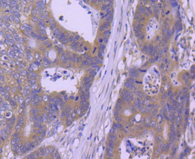 Anti-HSP105 Antibody (2M617)