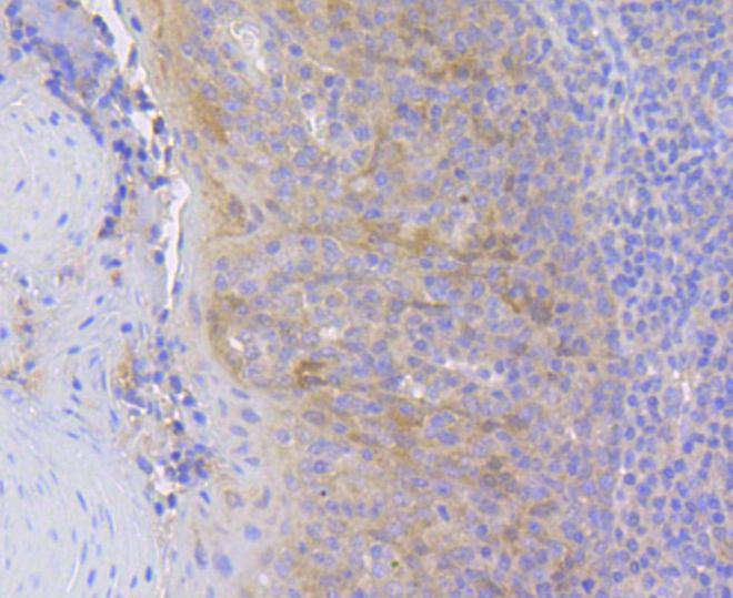 Anti-HSPA8 Antibody (5L224)