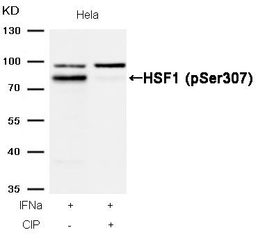 Anti-Phospho-HSF1 (Ser307) Polyclonal Antibody