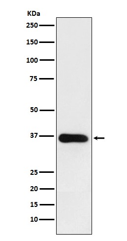 Anti-HSD11B1 Antibody (6B221)