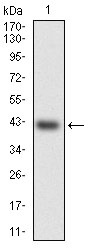 Anti-HSF4 Antibody (1L976)