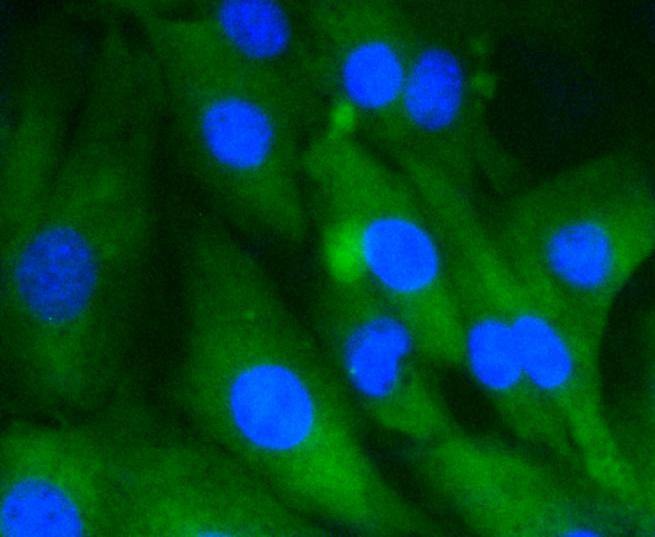Anti-HSPA8 Antibody (5L224)