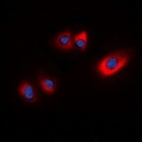 Anti-Phospho-HSP20 (Ser16) Polyclonal Antibody
