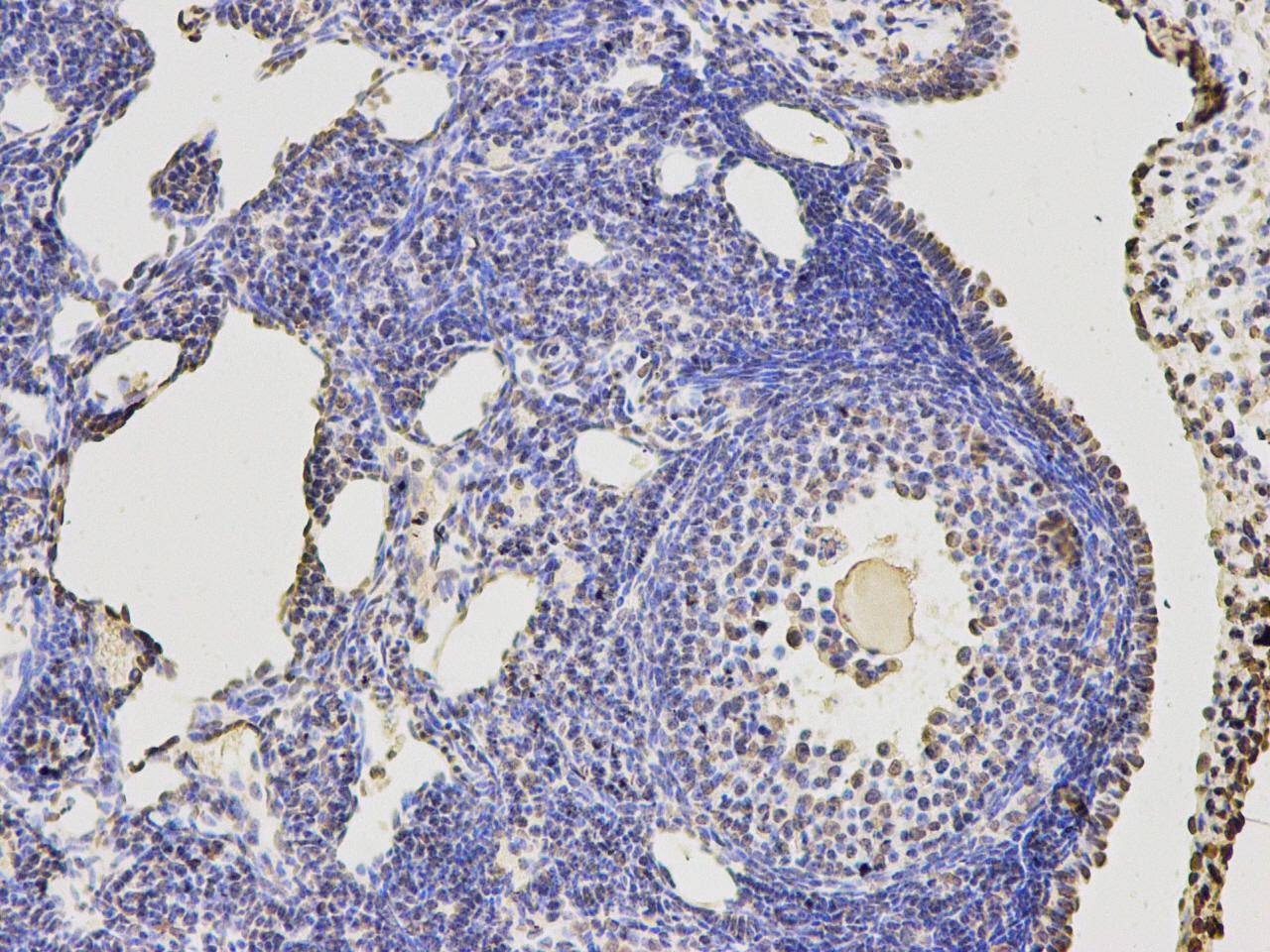 Anti-KLHDC3 Antibody (6T418)
