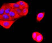 Anti-K63-linkage Specific Ubiquitin Antibody (7M837)