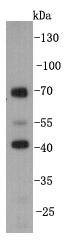 Anti-KLHDC3 Antibody (6T418)