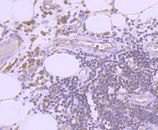 Anti-K63-linkage Specific Ubiquitin Antibody (7M837)
