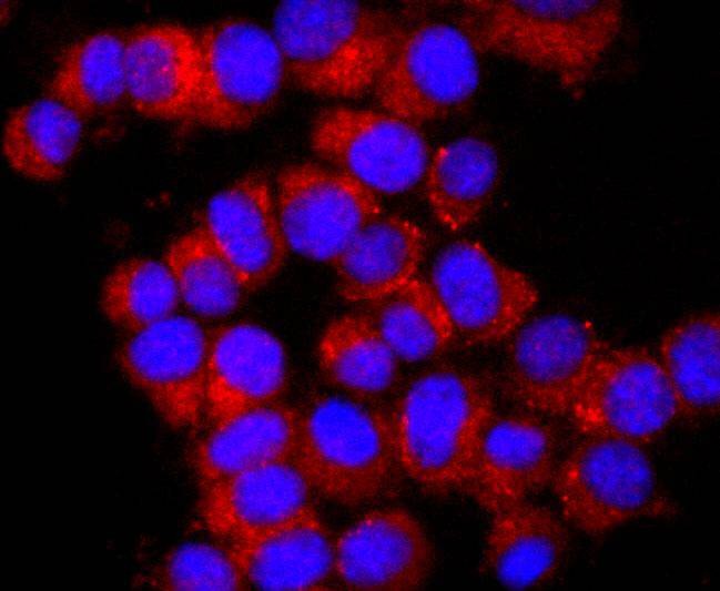 Anti-K63-linkage Specific Ubiquitin Antibody (7M837)