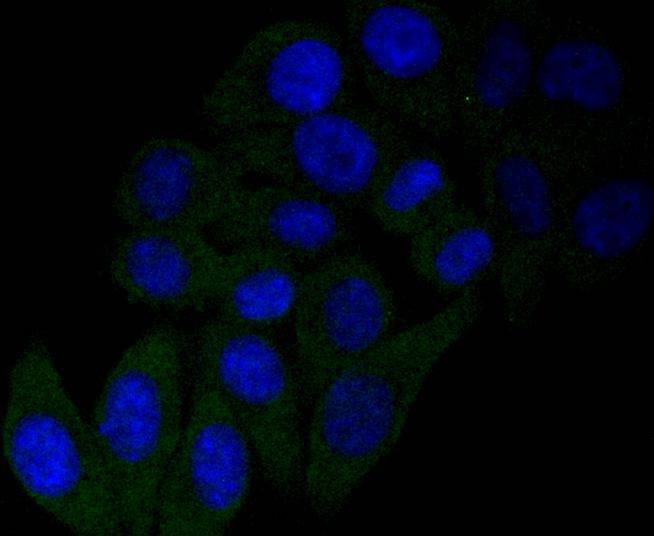 Anti-NGF Antibody (9K780)