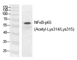 Anti-Acetyl-NF-kB p65 (Lys314, 315) Polyclonal Antibody