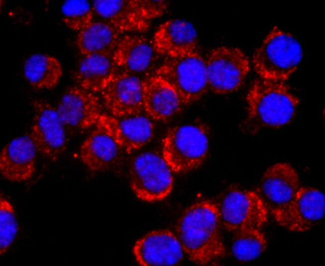 Anti-NCAM1 Antibody (1L189)