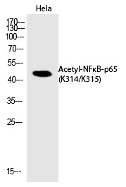 Anti-Acetyl-NF-kB p65 (Lys314, 315) Polyclonal Antibody