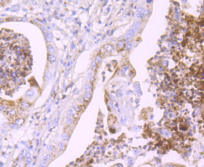 Anti-Lipocalin-2/LCN2 Antibody (7O248)