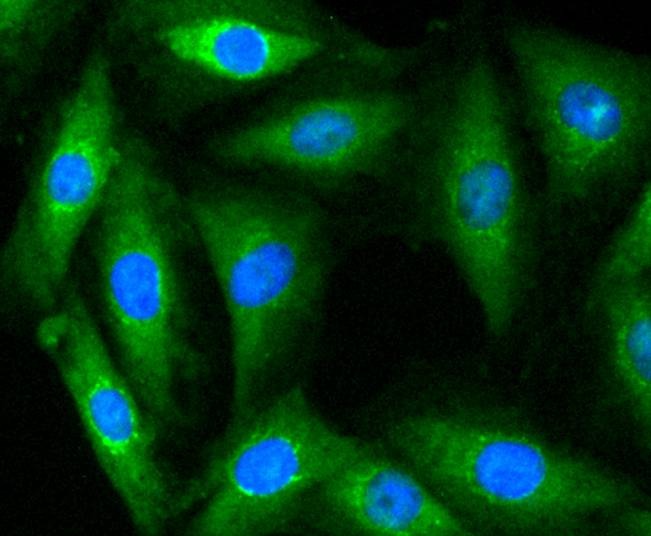 Anti-MYLK Antibody (1W61)