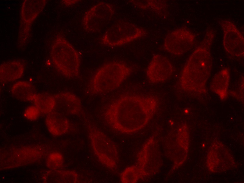 Anti-Phospho-NF-kB p65 (Ser468) Polyclonal Antibody 2