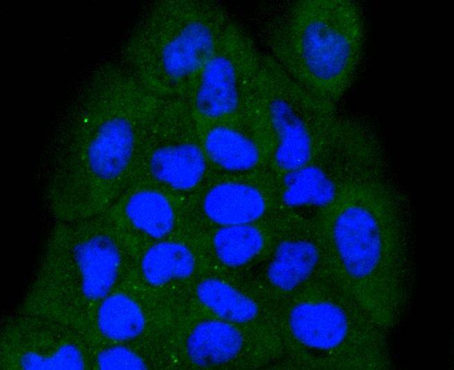 Anti-NOX4 Antibody (4J332)