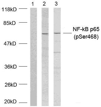 Anti-Phospho-NF-kB p65 (Ser468) Polyclonal Antibody 2