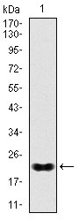Anti-NKX2.2 Antibody (1F181)