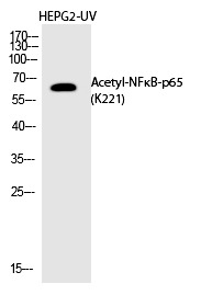 Anti-Acetyl-NF-kB p65 (Lys221) Polyclonal Antibody