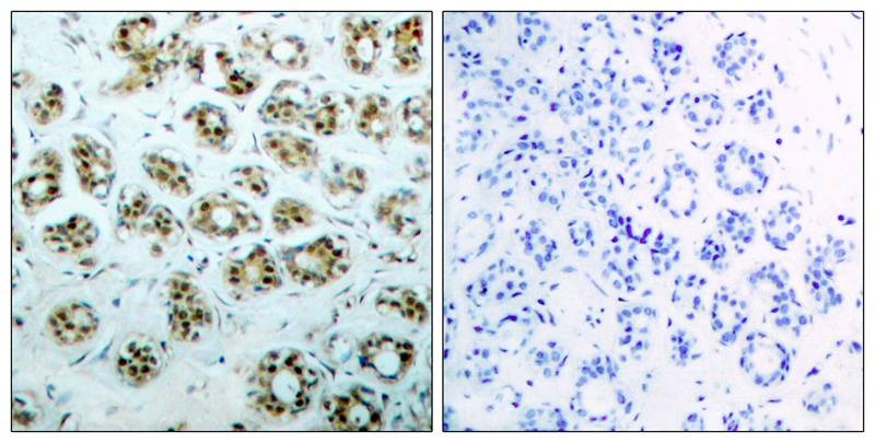 Anti-Phospho-NF-kB p65 (Ser311) Polyclonal Antibody