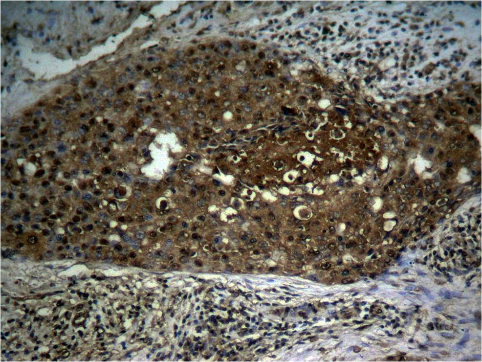 Anti-Phospho-NF-kB p65 (Ser276) Polyclonal Antibody 2