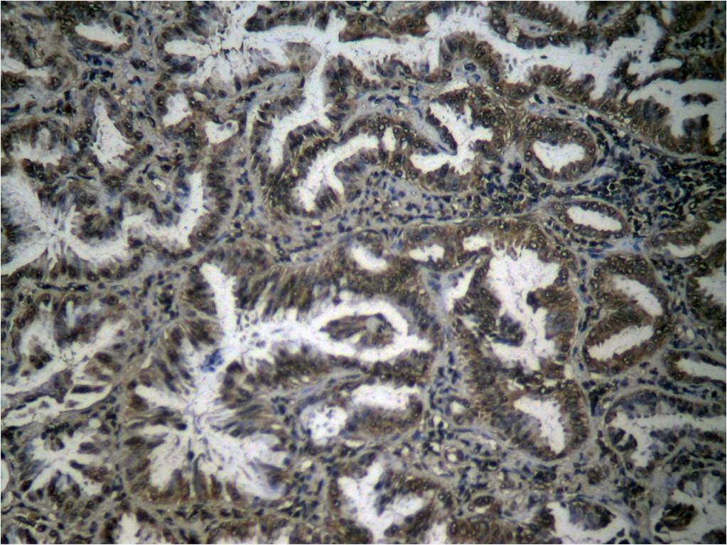 Anti-Phospho-NF-kB p65 (Ser276) Polyclonal Antibody 2