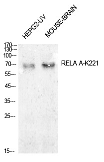Anti-Acetyl-NF-kB p65 (Lys221) Polyclonal Antibody