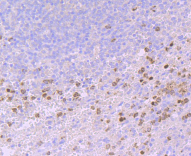 Anti-Lipocalin-2/LCN2 Antibody (7O248)