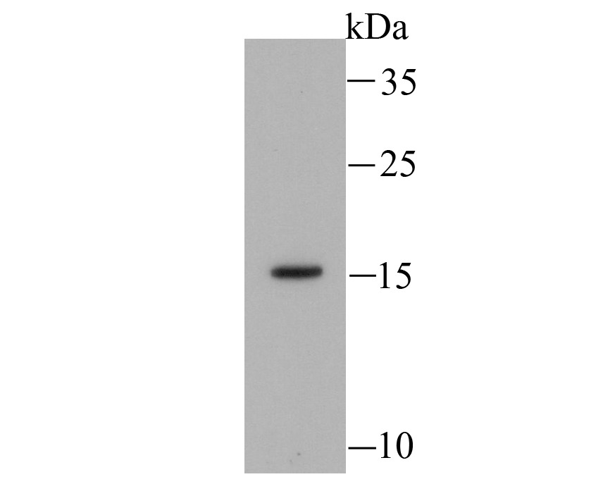 Anti-Myosin Light Chain 2 Antibody (9W601)