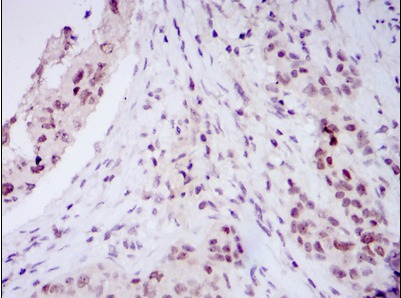 Anti-NACC1 Antibody (6F944)