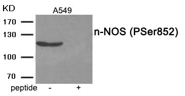 Anti-Phospho-nNOS (Ser852) Polyclonal Antibody