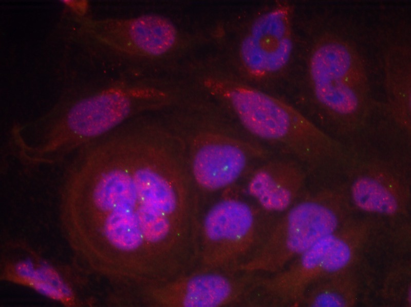 Anti-Phospho-NF-kB p65 (Ser276) Polyclonal Antibody 2