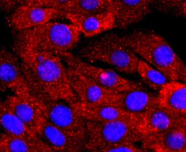 Anti-Lipocalin-2/LCN2 Antibody (7O248)