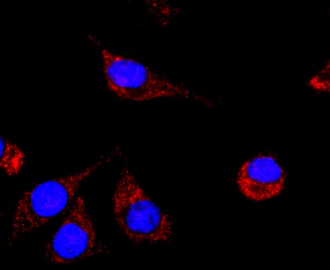 Anti-NCAM1 Antibody (1L189)