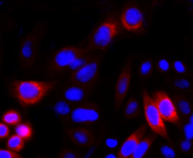 Anti-Lipocalin-2/LCN2 Antibody (7O248)