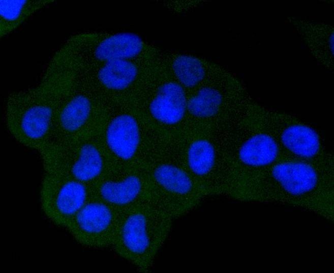 Anti-NOX4 Antibody (4J332)