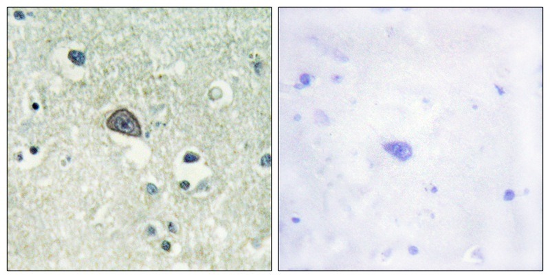 Anti-Phospho-GRIN1 (Ser890) Polyclonal Antibody 2