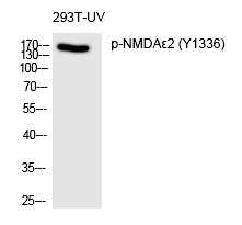 Anti-Phospho-NMDAR2B (Tyr1336) Polyclonal Antibody
