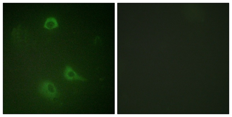 Anti-Phospho-GRIN1 (Ser890) Polyclonal Antibody 2