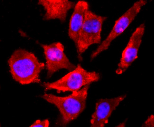 Anti-GRIN1 Antibody (2T28)