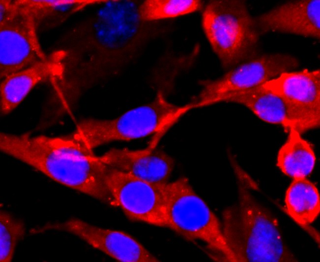 Anti-GRIN1 Antibody (2T28)